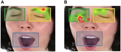 Patterns of Contagious Yawning and Itching Differ Amongst Adults With Autistic Traits vs. Psychopathic Traits